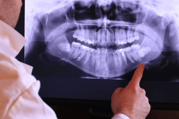 Best Emergency Dentist for Knocked-Out Tooth in Five Points, FL